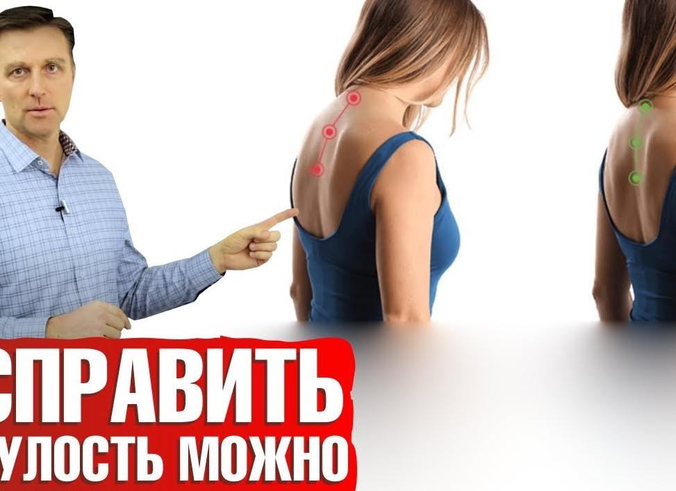 Сутулость