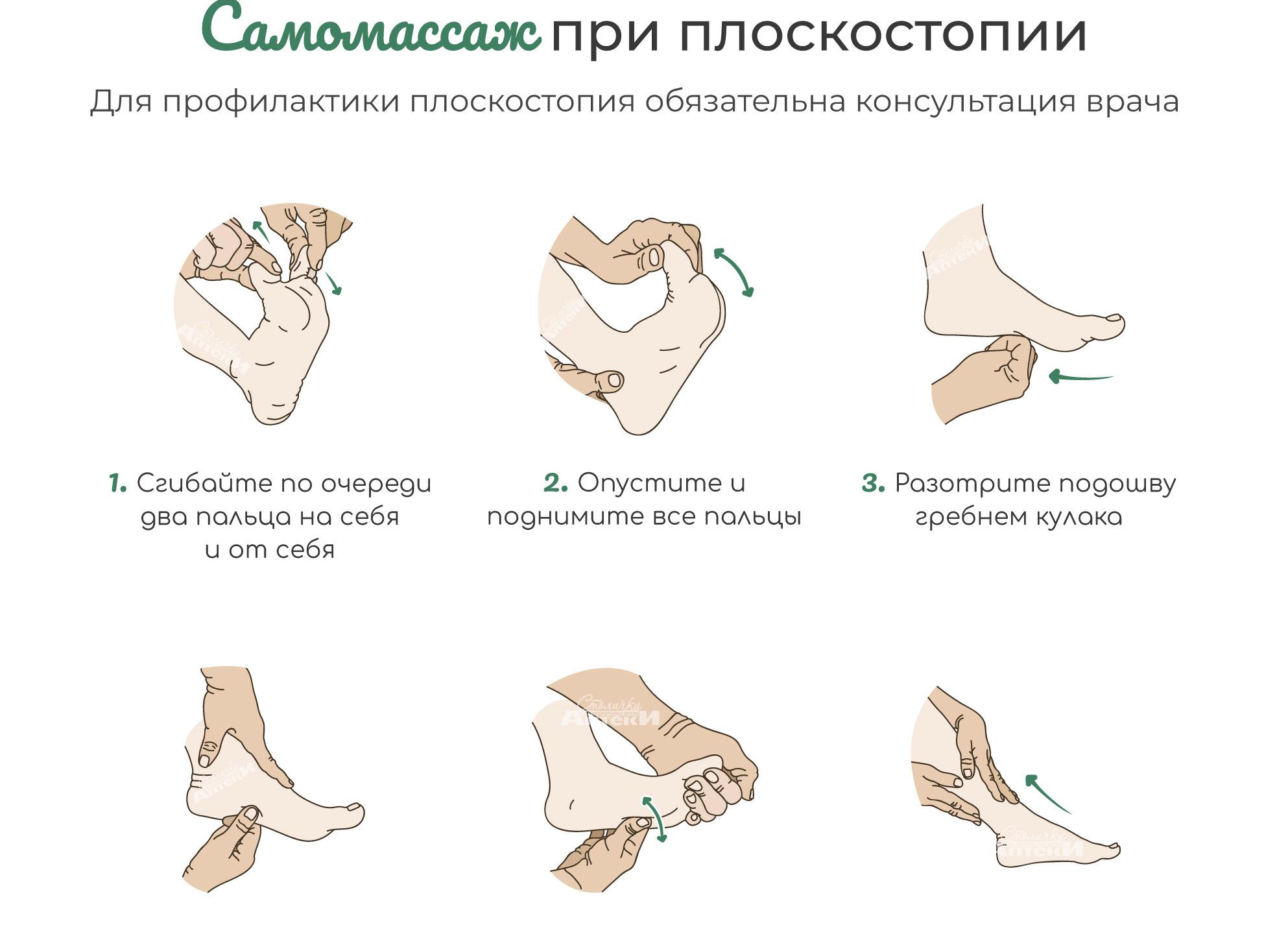 Массаж при плоскостопии