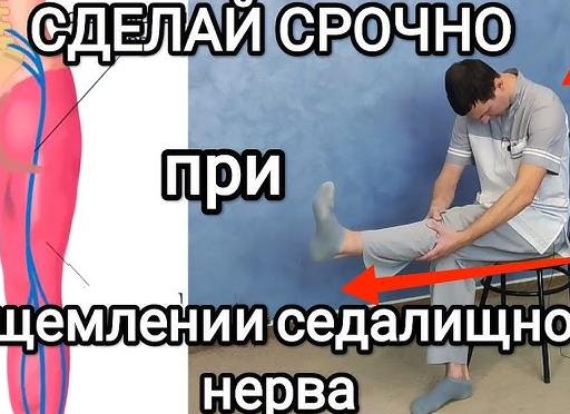 Воспаление седалищного нерва
