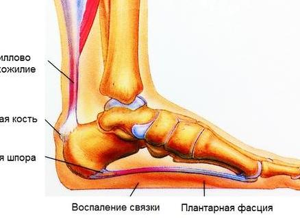 Боли в ступнях